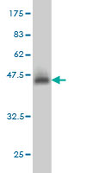 YY1 monoclonal antibody (M02), clone 4A5