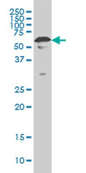 YY1 monoclonal antibody (M02), clone 4A5