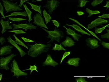 TUBB2A monoclonal antibody (M03), clone 2B2