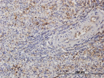 TUBB2A monoclonal antibody (M03), clone 2B2