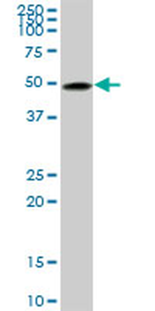 TUBB2A monoclonal antibody (M03), clone 2B2