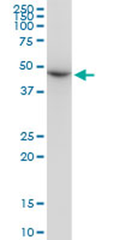 TUBB2A monoclonal antibody (M03), clone 2B2