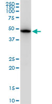 TUBB2A monoclonal antibody (M03), clone 2B2