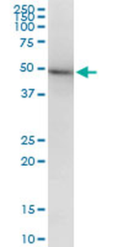 TUBB2A monoclonal antibody (M03), clone 2B2