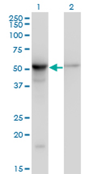 TUBB2A monoclonal antibody (M03), clone 2B2