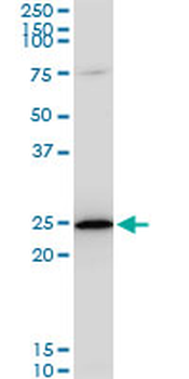 TPT1 monoclonal antibody (M06), clone 2A3