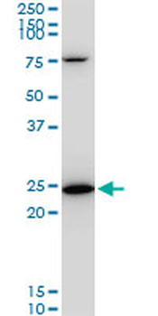 TPT1 monoclonal antibody (M06), clone 2A3