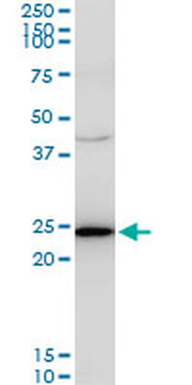 TPT1 monoclonal antibody (M06), clone 2A3