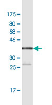 TPT1 monoclonal antibody (M06), clone 2A3