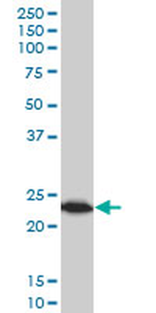 TPT1 monoclonal antibody (M03), clone 2C4