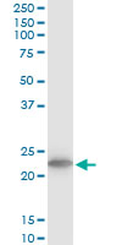 TPT1 monoclonal antibody (M03), clone 2C4