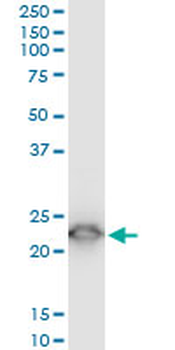 TPT1 monoclonal antibody (M03), clone 2C4