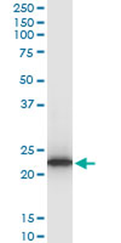 TPT1 monoclonal antibody (M03), clone 2C4