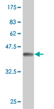 TPT1 monoclonal antibody (M03), clone 2C4