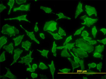 TPT1 monoclonal antibody (M01), clone 3C7