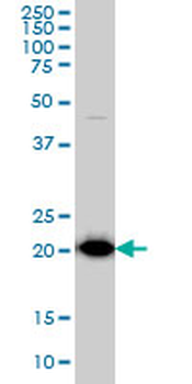 TPT1 monoclonal antibody (M01), clone 3C7