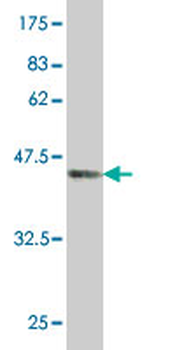 TPT1 monoclonal antibody (M01), clone 3C7