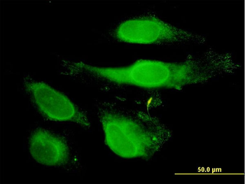 PRDX2 monoclonal antibody (M01), clone 4E10-2D2