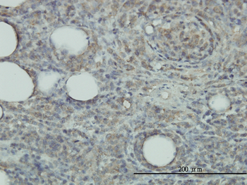 PRDX2 monoclonal antibody (M01), clone 4E10-2D2