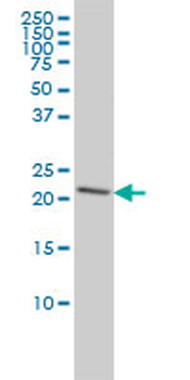 PRDX2 monoclonal antibody (M01), clone 4E10-2D2