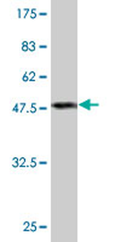 PRDX2 monoclonal antibody (M01), clone 4E10-2D2