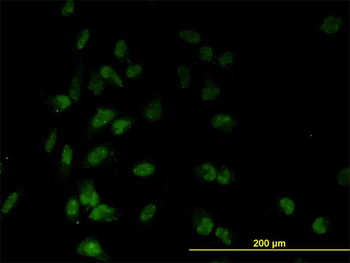 TAF7 monoclonal antibody (M01), clone 2C5