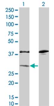 SULT1A1 monoclonal antibody (M01A), clone 1F8