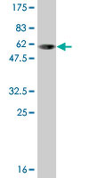 SULT1A1 monoclonal antibody (M01A), clone 1F8