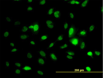 AURKA monoclonal antibody (M01), clone 5F8