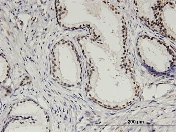 AURKA monoclonal antibody (M01), clone 5F8