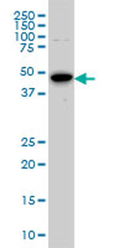 AURKA monoclonal antibody (M01), clone 5F8