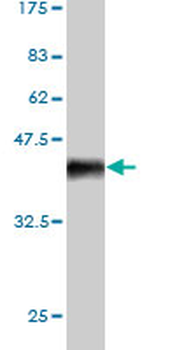 AURKA monoclonal antibody (M01), clone 5F8