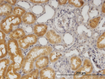 SORD monoclonal antibody (M01), clone 4D3