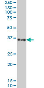 SORD monoclonal antibody (M01), clone 4D3