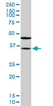 SORD monoclonal antibody (M01), clone 4D3