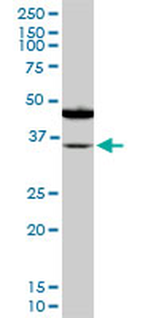 SORD monoclonal antibody (M01), clone 4D3