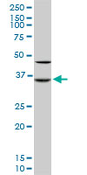 SORD monoclonal antibody (M01), clone 4D3