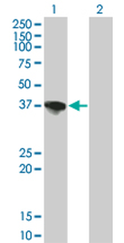 SORD monoclonal antibody (M01), clone 4D3