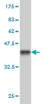 SORD monoclonal antibody (M01), clone 4D3