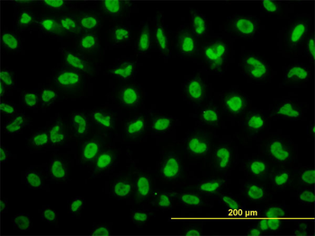 SNAI2 monoclonal antibody (M04), clone 4D11