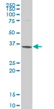 SNAI2 monoclonal antibody (M04), clone 4D11