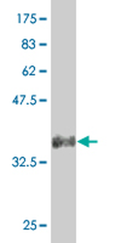 SNAI2 monoclonal antibody (M04), clone 4D11