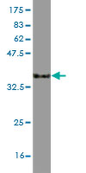 CCL3 monoclonal antibody (M01), clone 4E7