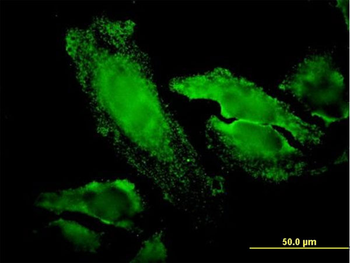 RPS7 monoclonal antibody (M03), clone 3G4