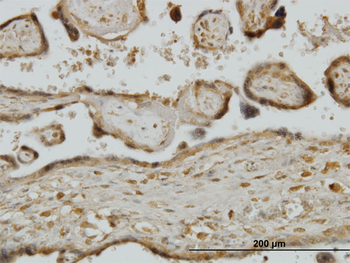 RPS7 monoclonal antibody (M03), clone 3G4