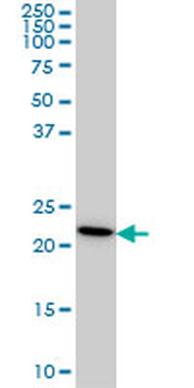 RPS7 monoclonal antibody (M03), clone 3G4