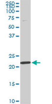 RPS7 monoclonal antibody (M03), clone 3G4