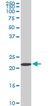 RPS7 monoclonal antibody (M03), clone 3G4