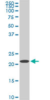 RPS7 monoclonal antibody (M03), clone 3G4