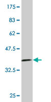 RPS7 monoclonal antibody (M03), clone 3G4